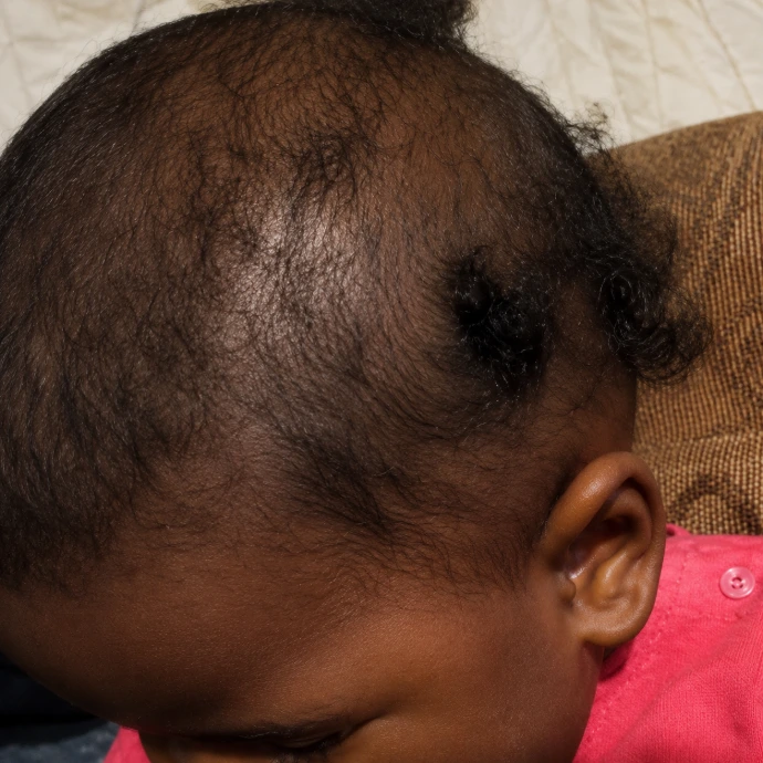 Client result 6 before using KlutchJa Organics products